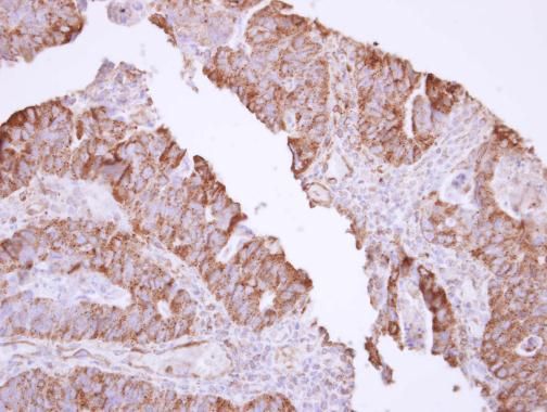 MX1 antibody [N2C2], Internal