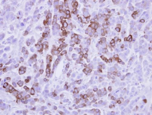 MX1 antibody