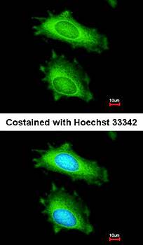 MX1 antibody