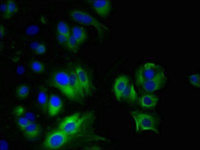 MYADM Antibody