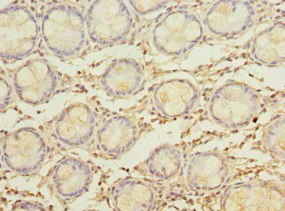 MYADM Antibody