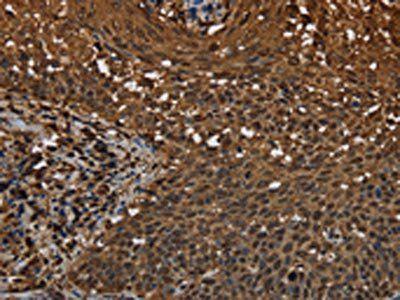 MYBBP1A Antibody