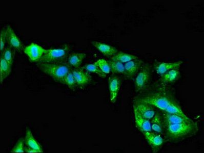 MYBPC2 Antibody