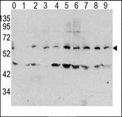 MYC (phospho-Thr58) antibody