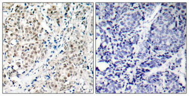 MYC Antibody