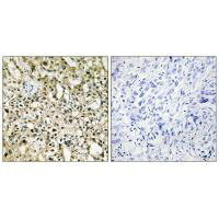 MYC Antibody