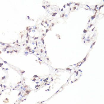 MYC (Phospho-S62) antibody