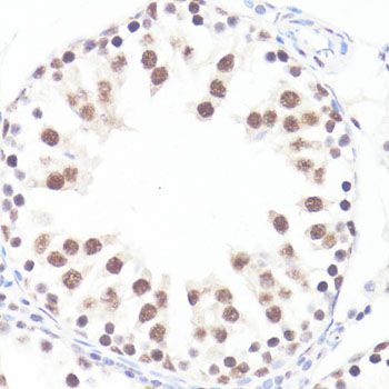 MYC (Phospho-S62) antibody