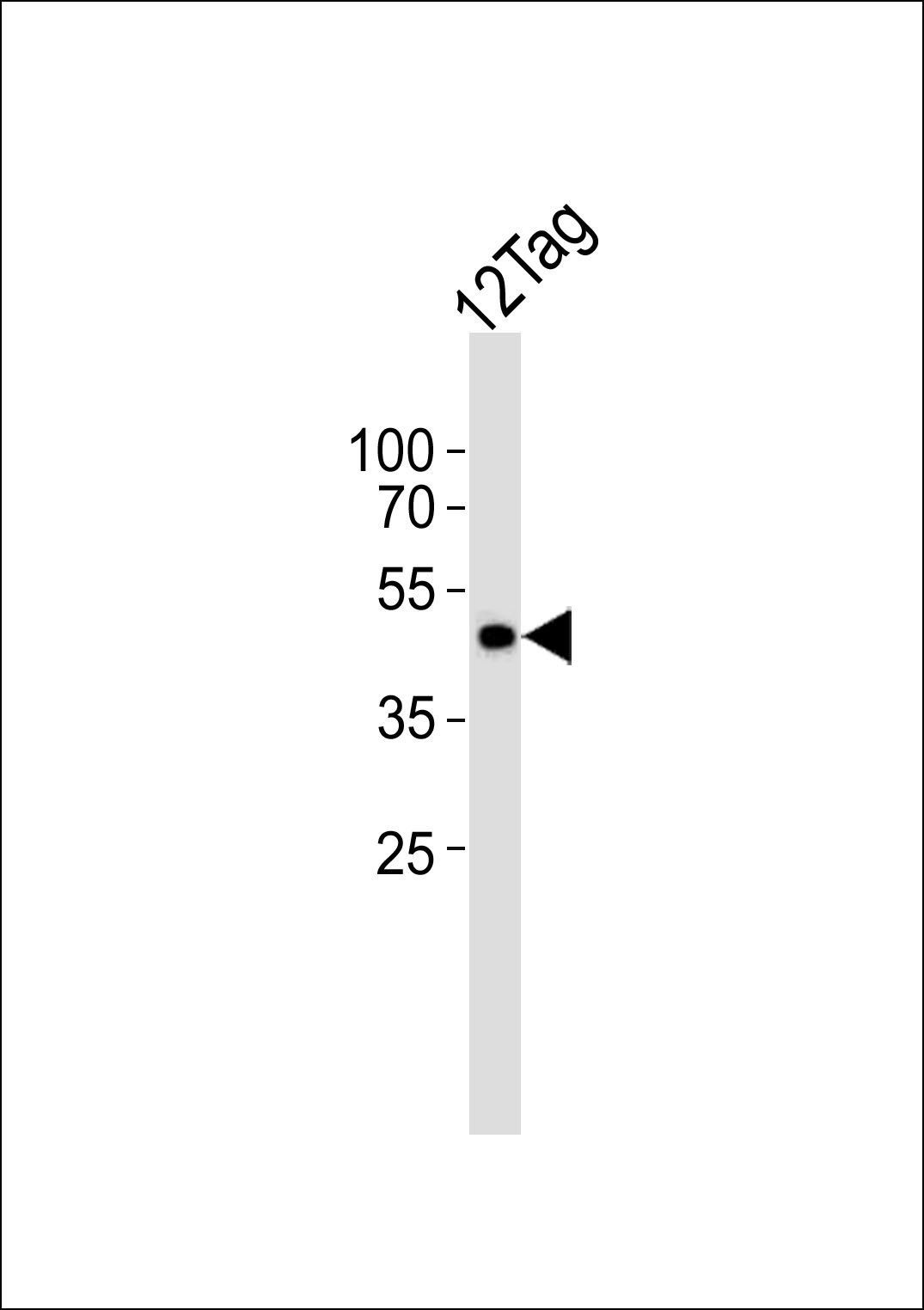 Myc Tag antibody