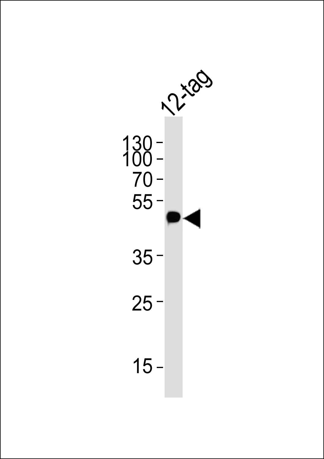 Myc Tag antibody