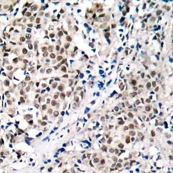 Myc (Ab-358) Antibody