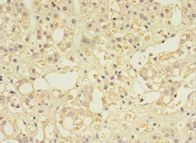 MYCBP Antibody