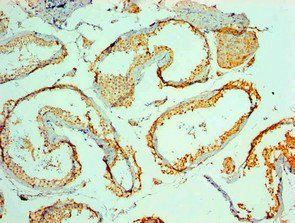MYCBP Antibody