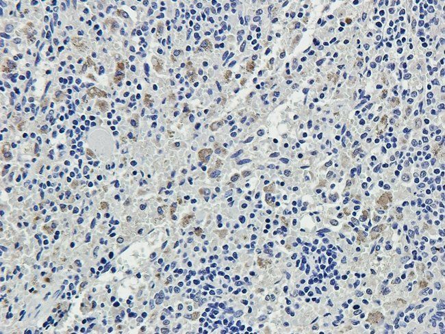 MYD88 antibody