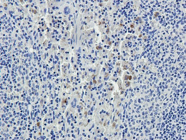 MYD88 antibody