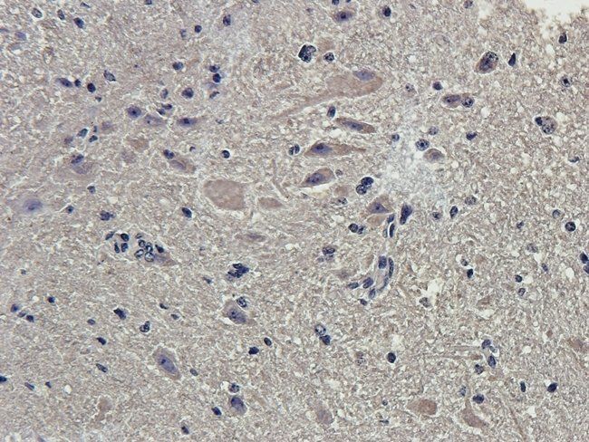 MYD88 antibody