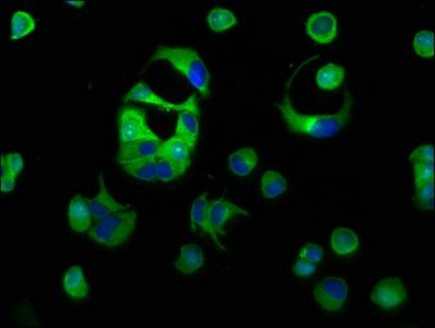 Myelin-associated glycoprotein antibody