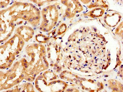 Myelin-associated glycoprotein antibody