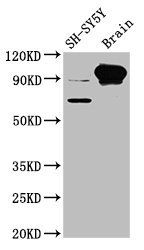 Myelin-associated glycoprotein antibody