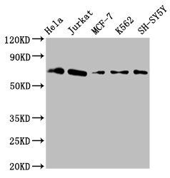 Myelin-associated glycoprotein antibody