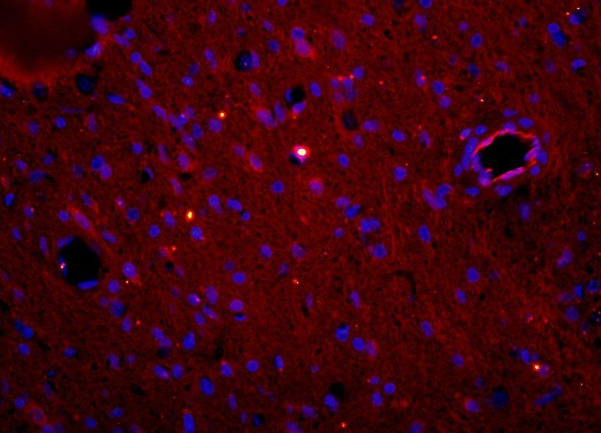 Myeloperoxidase antibody