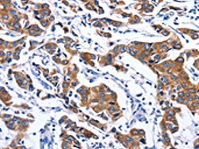 MYH1 Antibody