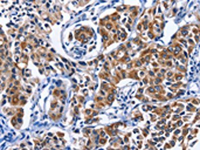MYH1 Antibody