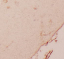MYH10-Specific antibody
