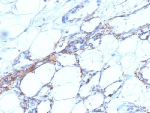 MYH11 Antibody