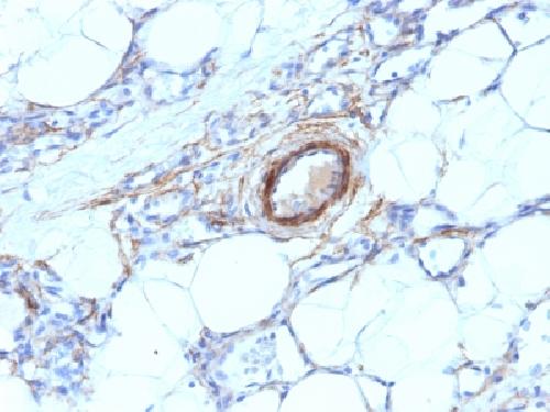 Smooth Muscle Myosin Heavy Chain (SM-MHC) Antibody