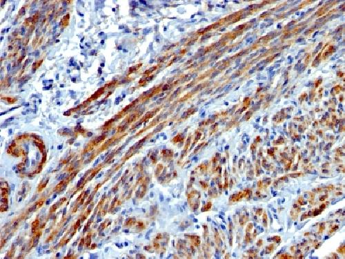 Smooth Muscle Myosin Heavy Chain (SM-MHC) Antibody