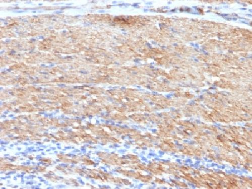 Smooth Muscle Myosin Heavy Chain (SM-MHC) Antibody