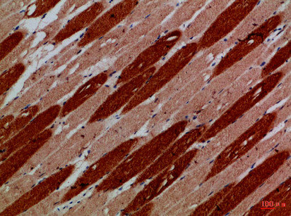 MYH6/MYH7 Antibody