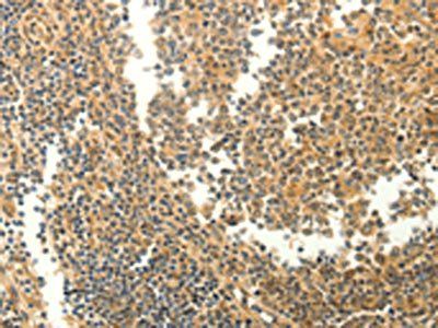 MYH7 Antibody