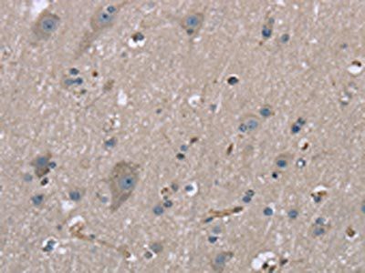 MYL12B Antibody