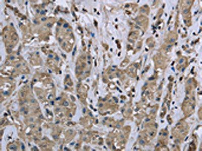 MYL12B Antibody