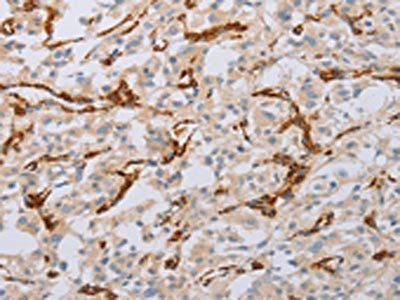 MYL6 antibody