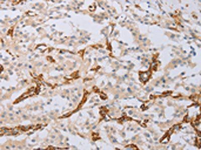 MYL6 antibody