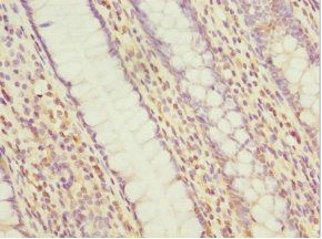 MYLK3 Antibody