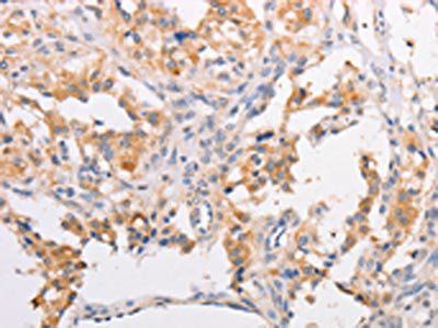 MYLK3 antibody