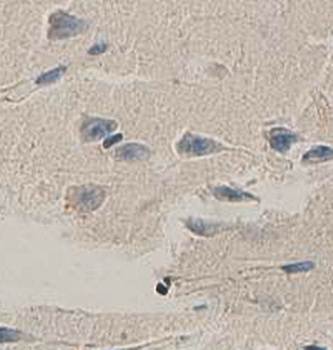 Amyloid beta A4 Rabbit Polyclonal Antibody