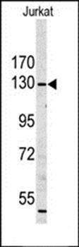 MYO1A antibody