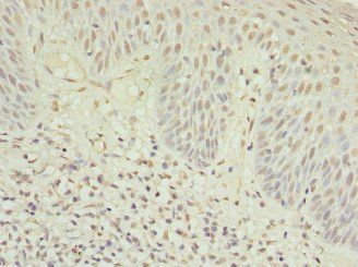 MYO1C Antibody