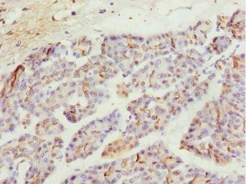 MYO5C Antibody