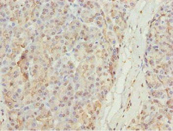 MYO5C Antibody