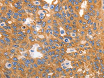 MYOD1 Antibody