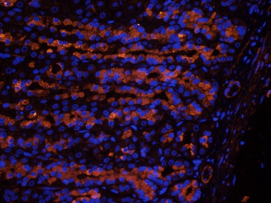 Myoglobin antibody