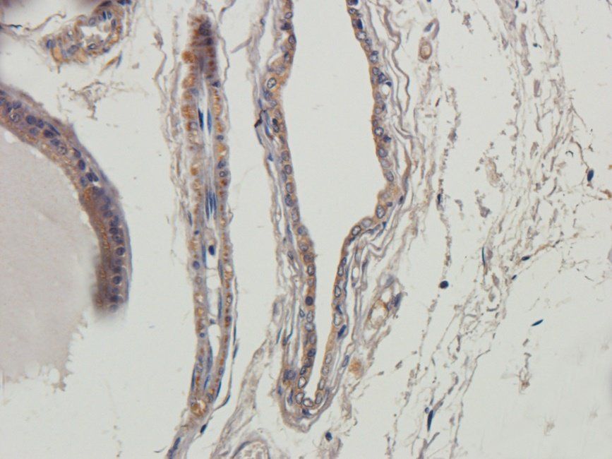 Myoglobin antibody