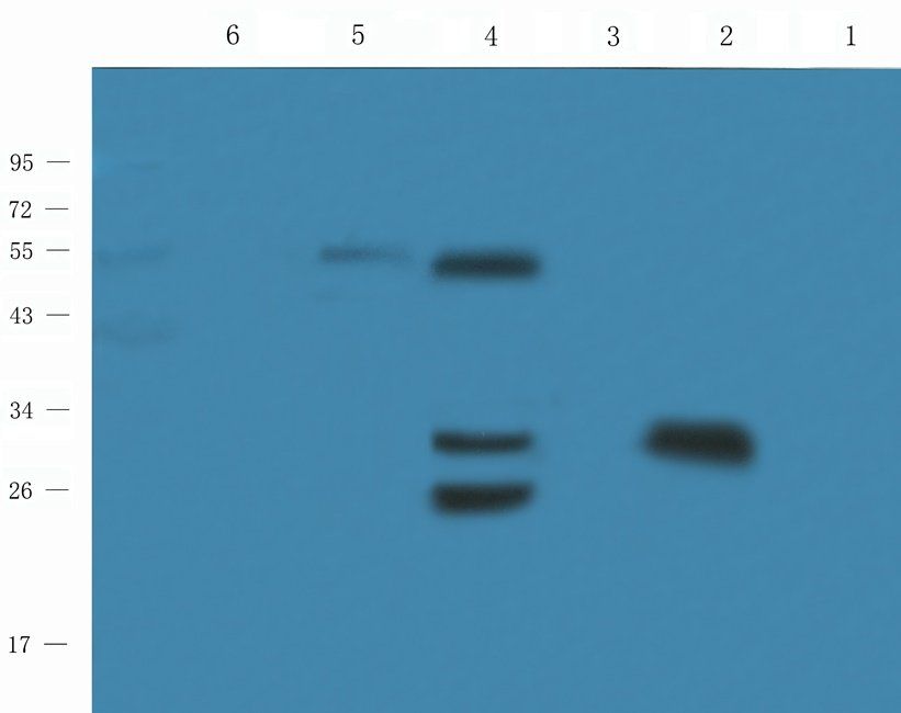 Myoglobin antibody