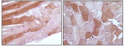 Myoglobin Antibody